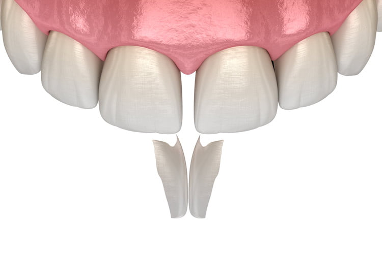 Hathorne Family Dental
