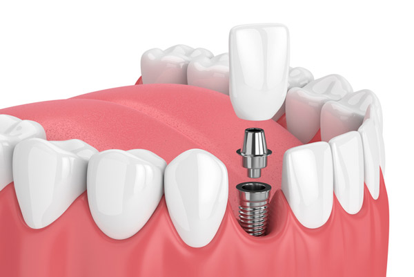 Hathorne Family Dental