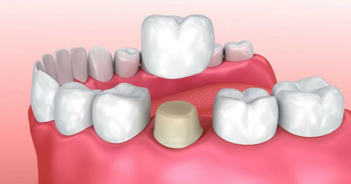 Hathorne Family Dental