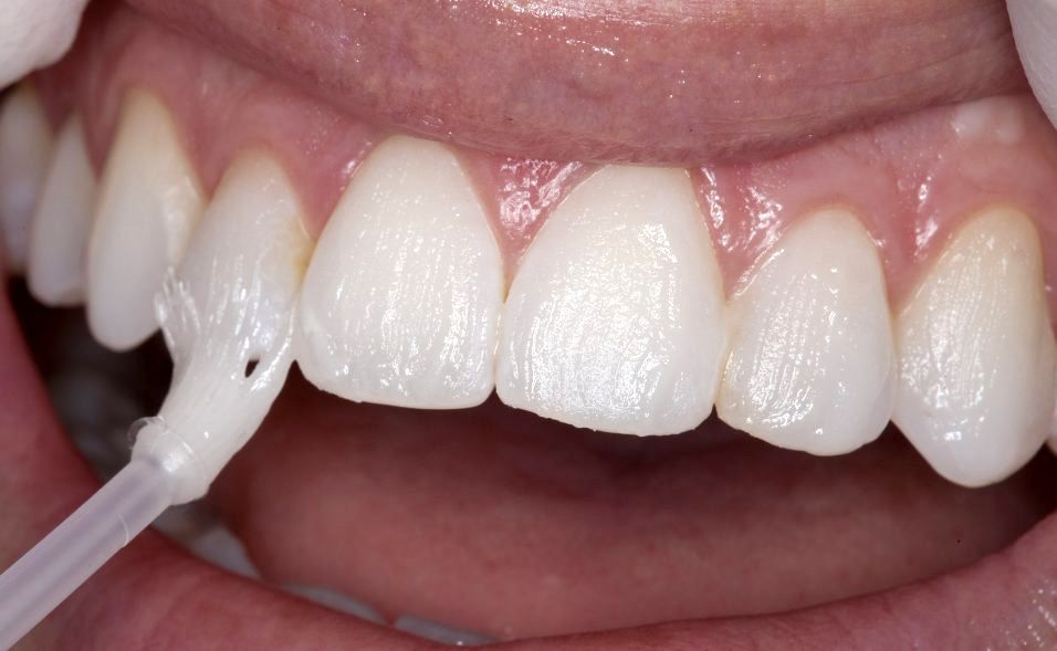 Hathorne Family Dental