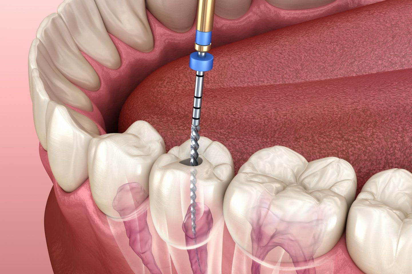 Hathorne Family Dental