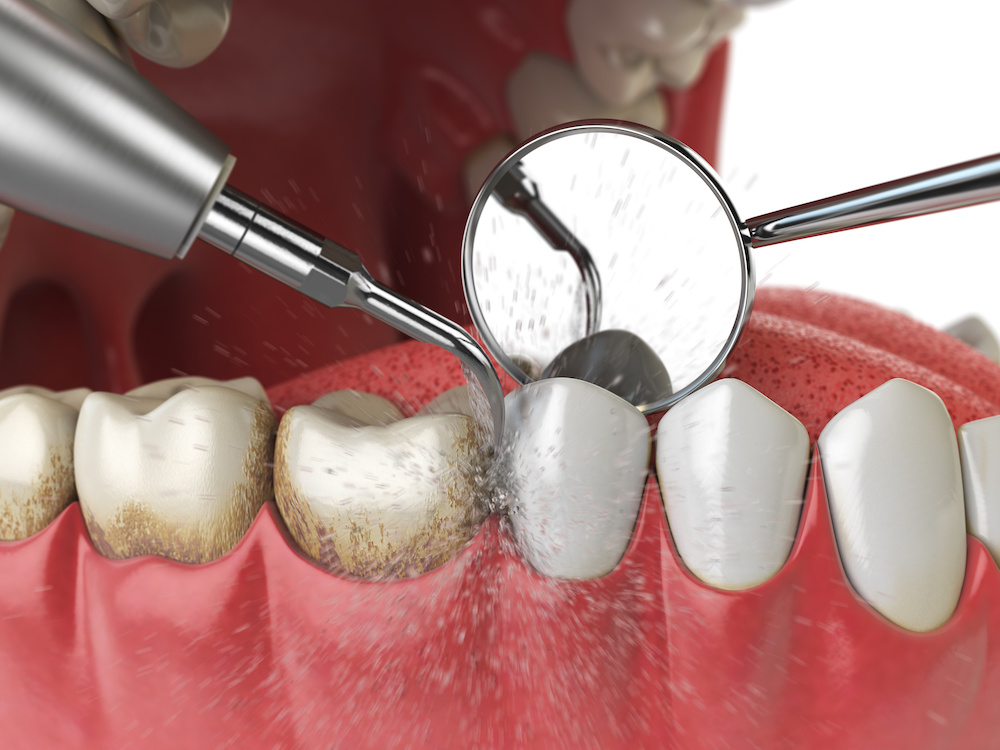 Hathorne Family Dental