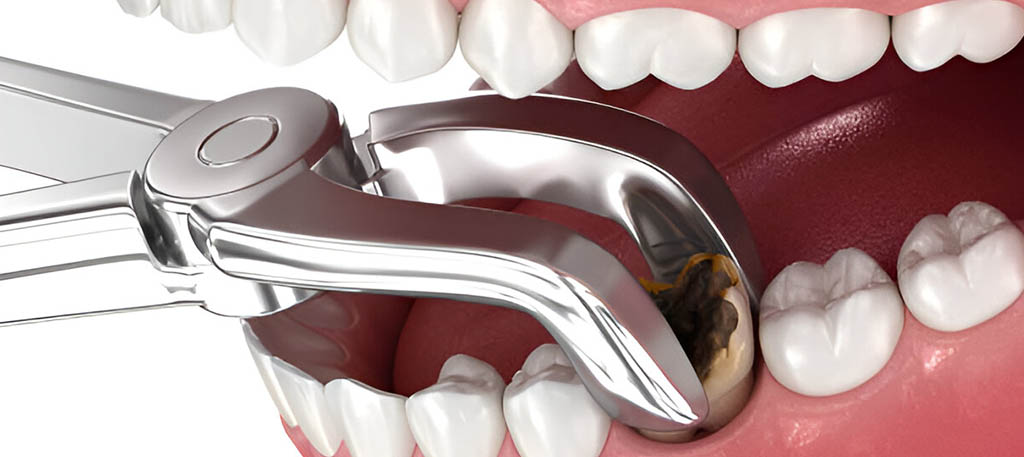 Hathorne Family Dental